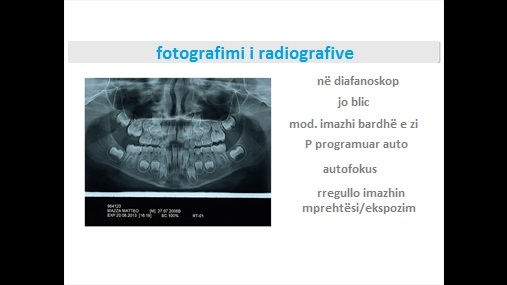 Fig. 20 Fotografimi i radiografive