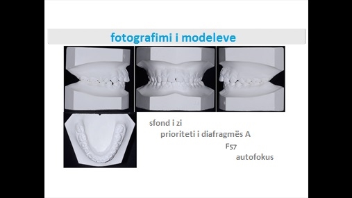 Fig. 21 Fotografimi i modeleve në shkumës