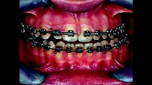 Fig.4: Pacientja ftohet tek ortodonti pr zgjidhjen e probleme t vrejtura