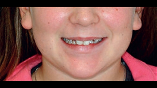 Fig. 1 Buzëqeshja e pacientes para vëzhgimit